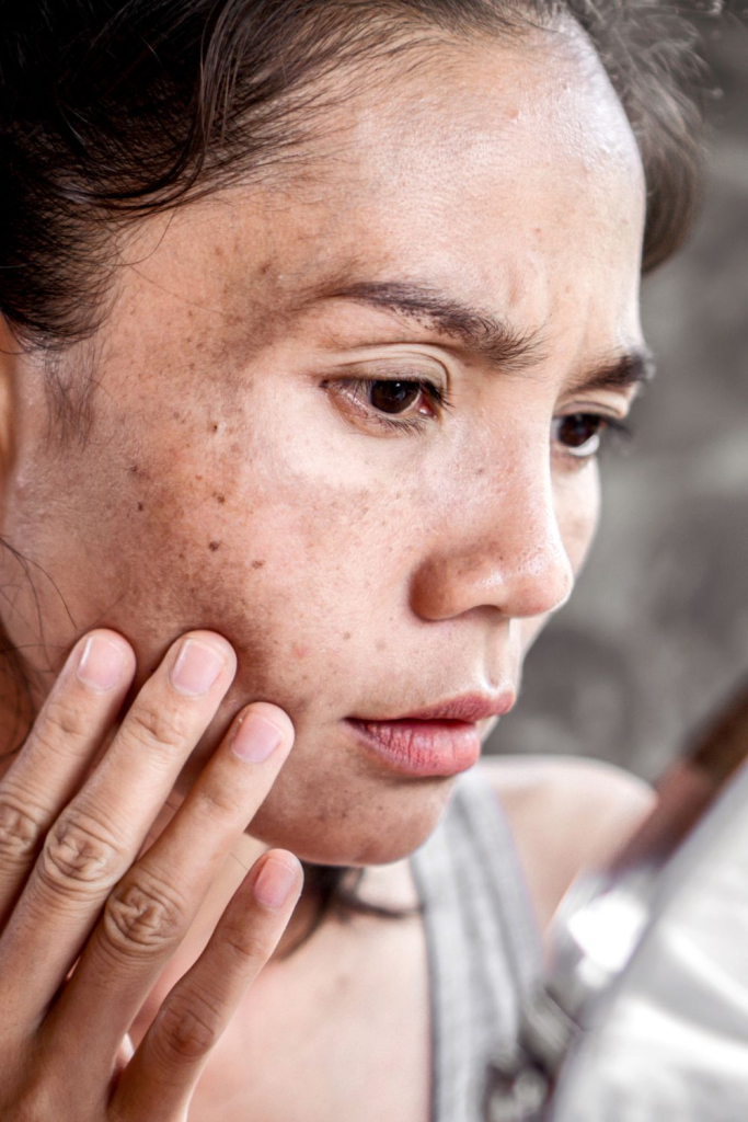NÁM NỘI TIẾT VÀ STRESS