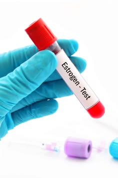 TÓC BẠC VÀ ESTROGEN CÓ LIÊN QUAN KHÔNG?