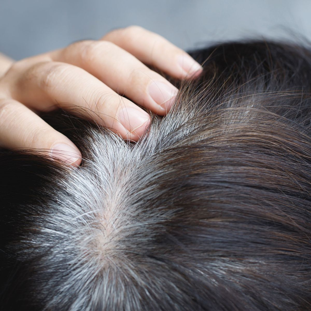 TÓC BẠC VÀ STRESS THẦN KINH MÃN TÍNH