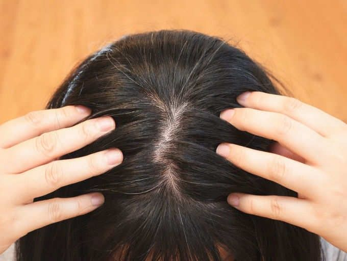 TỰ MIỄN VÀ TÓC BẠC MIỄN DỊCH