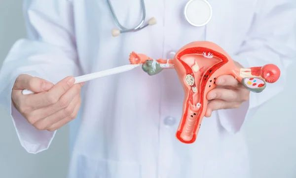 HỘI CHỨNG BUỒNG TRỨNG ĐA NANG