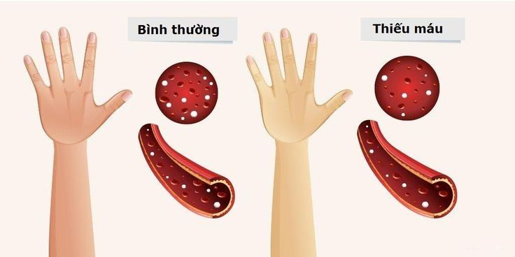 PHƯƠNG PHÁP PHÒNG NGỪA THIẾU MÁU Ở PHỤ NỮ